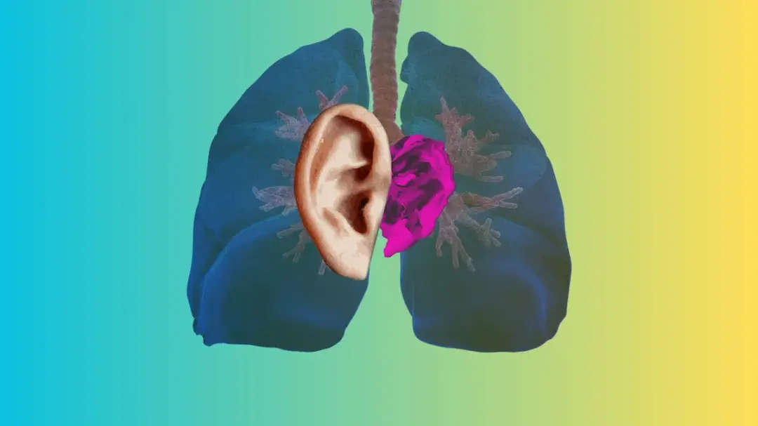 Ear Transplant: Launch concert at H15
