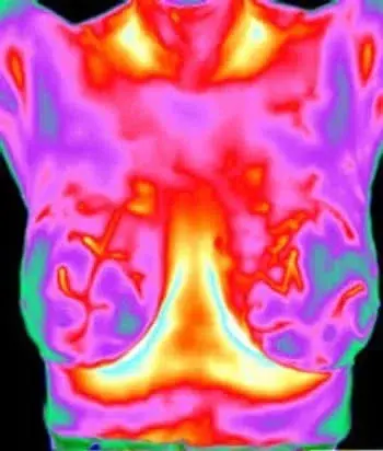 Thermography Breast Health Scan